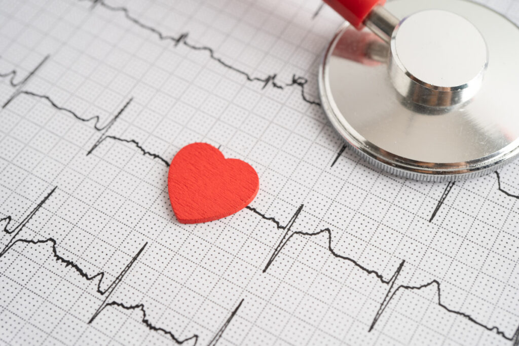Ce este electrocardiograma, când se impune să o faci și de ce să alegi M Hospital